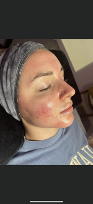 yelp 1 Your Community Marketplace: It's quick and easy. Learn, Shop, Sell, and connect with friends and family.